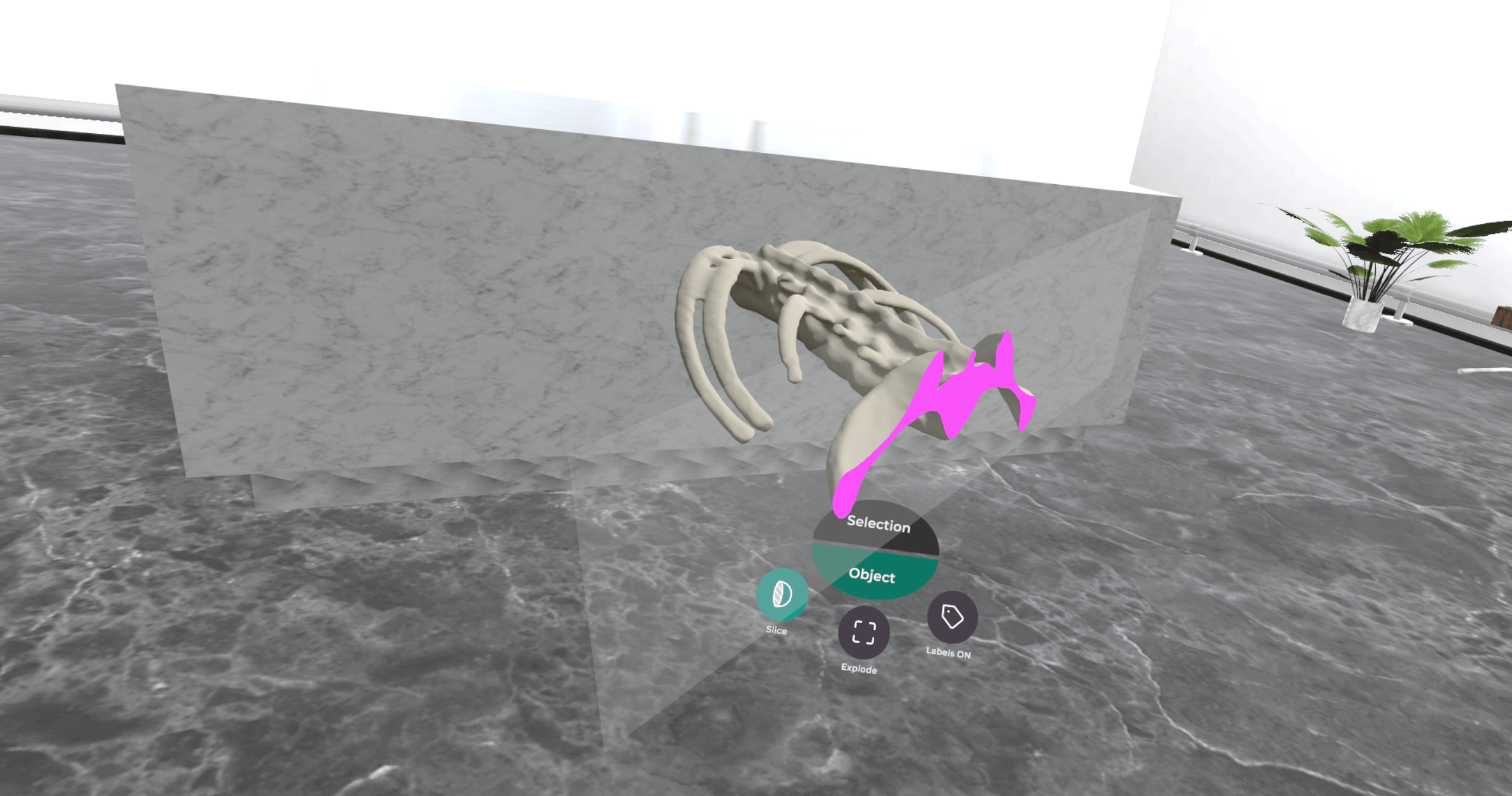 MRI with slice min -