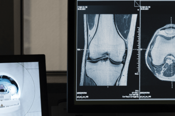 Case BodyScope banner 353x235 -