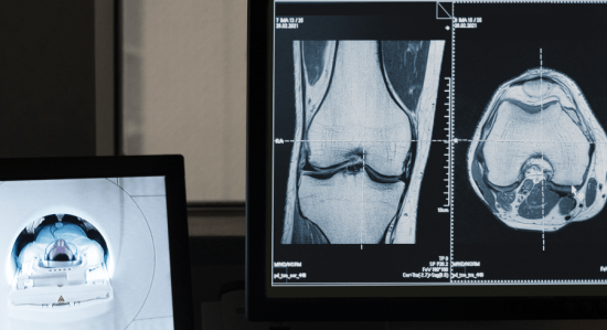 Case BodyScope banner 550x299 - Portfolio