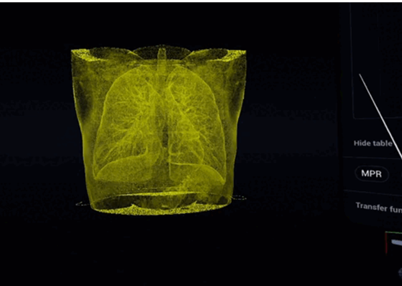 Case Bodyscope 2 1 -